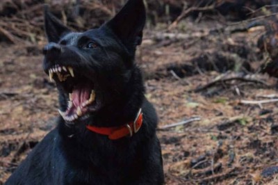 Woman Survives Terrifying Dog Attack, Leading to Leg Amputation - Her Brave Actions Will Leave You Speechless!